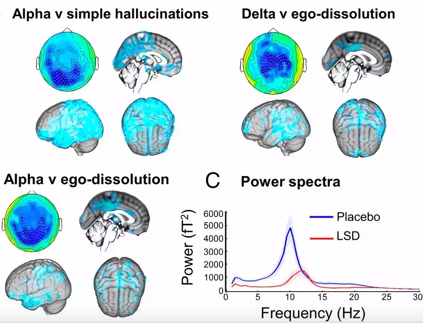 Correlações neurais da experiência LSD revelada pela neuroimagem multimodal